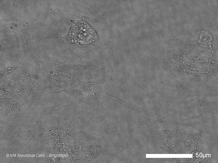 B 104 Neuronal Cells - Brightfield 50µm 