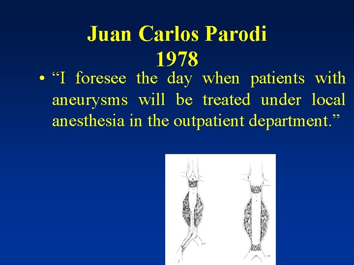 Juan Carlos Parodi 1978 • “I foresee the day when patients with aneurysms will