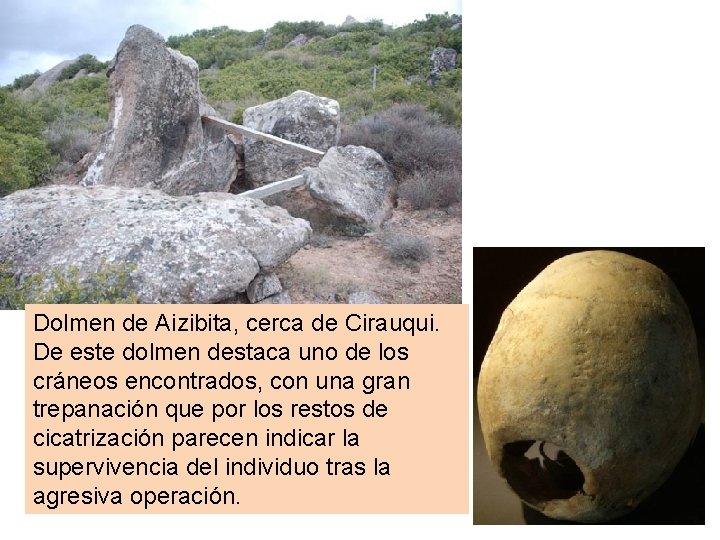 Dolmen de Aizibita, cerca de Cirauqui. De este dolmen destaca uno de los cráneos