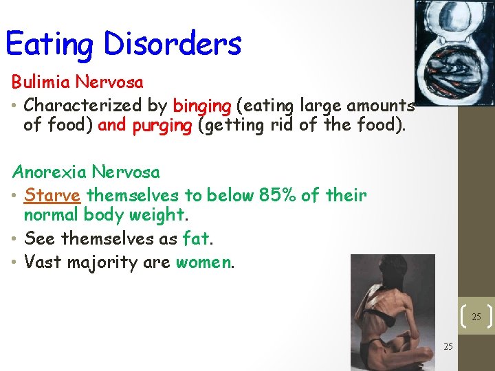 Eating Disorders Bulimia Nervosa • Characterized by binging (eating large amounts of food) and