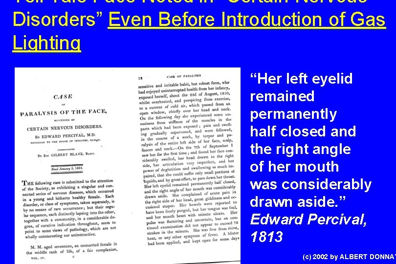 Tell Tale Face Noted in “Certain Nervous Disorders” Even Before Introduction of Gas Lighting