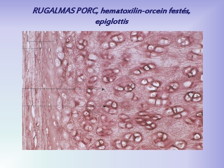 RUGALMAS PORC, hematoxilin-orcein festés, epiglottis 