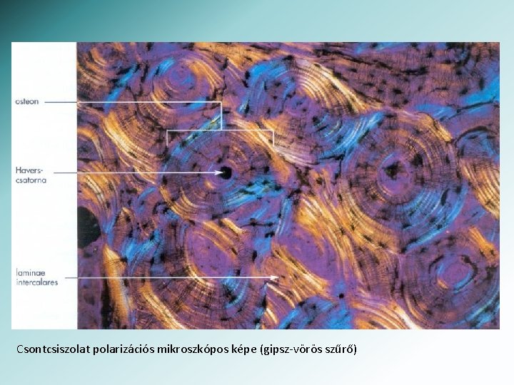 Csontcsiszolat polarizációs mikroszkópos képe (gipsz-vörös szűrő) 