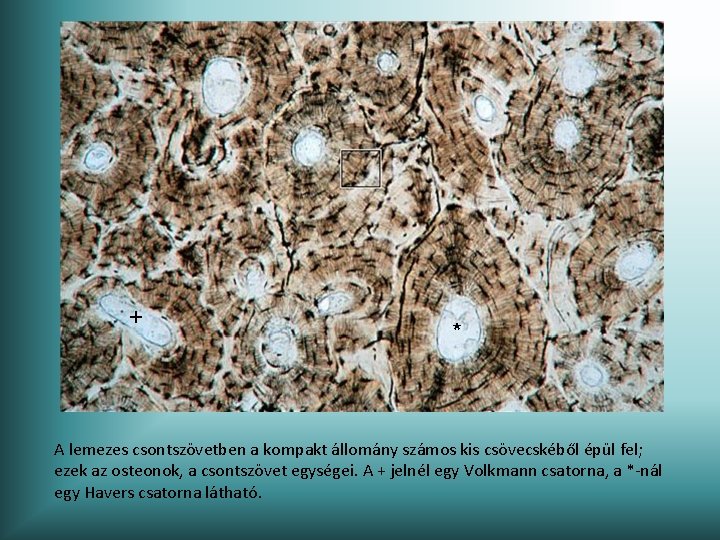 + * A lemezes csontszövetben a kompakt állomány számos kis csövecskéből épül fel; ezek