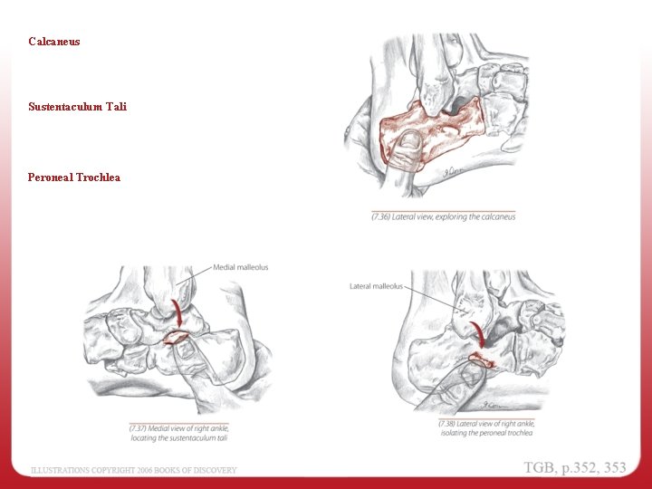 Calcaneus Sustentaculum Tali Peroneal Trochlea 