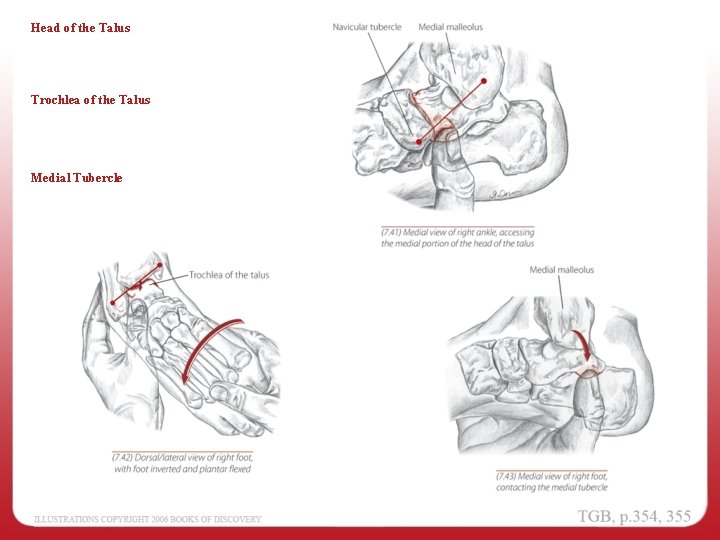 Head of the Talus Trochlea of the Talus Medial Tubercle 