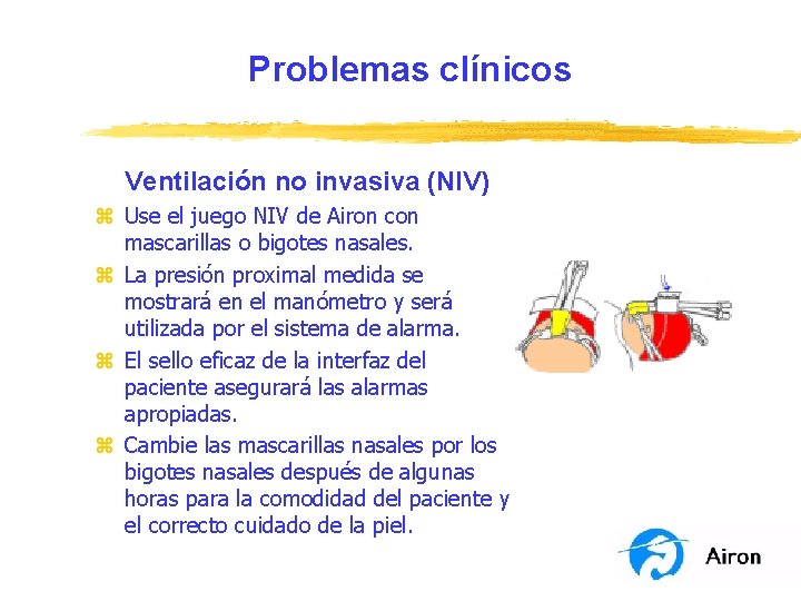 Problemas clínicos Ventilación no invasiva (NIV) z Use el juego NIV de Airon con