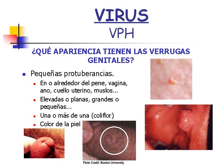 VIRUS VPH ¿QUÉ APARIENCIA TIENEN LAS VERRUGAS GENITALES? n Pequeñas protuberancias. n n En