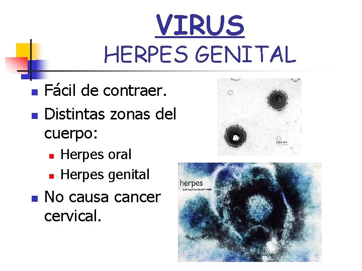 VIRUS HERPES GENITAL n n Fácil de contraer. Distintas zonas del cuerpo: n n