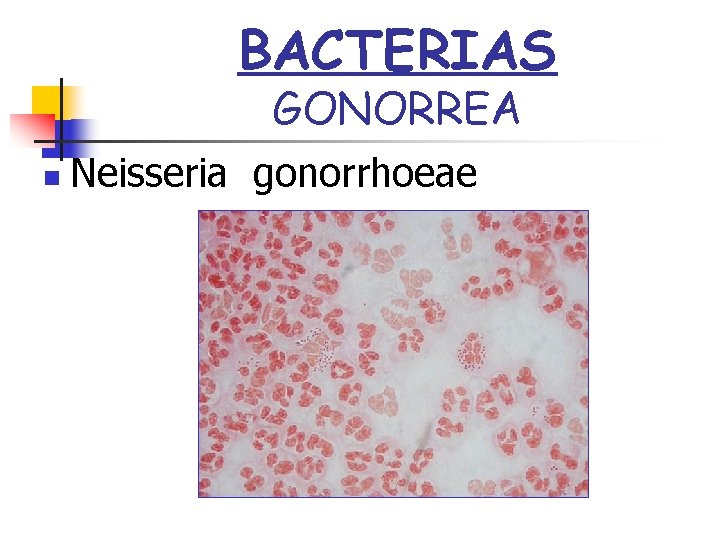 BACTERIAS GONORREA n Neisseria gonorrhoeae 