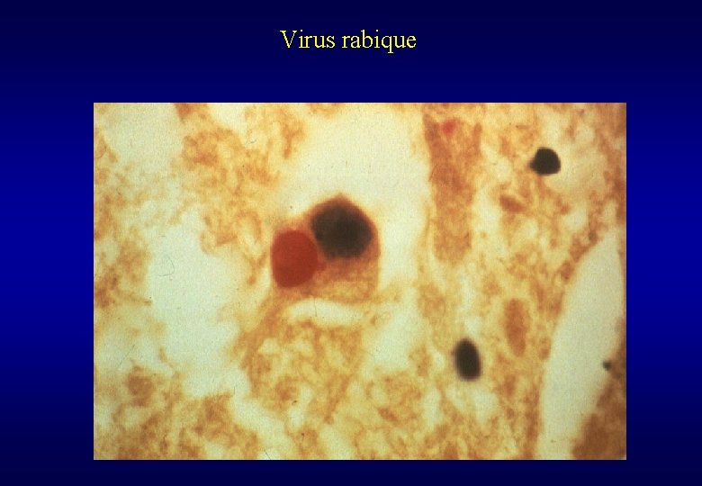 Virus rabique 