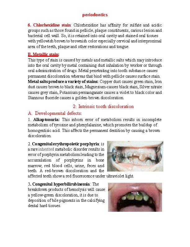 periodontics 6. Chlorhexidine stain: Chlorhexidine has affinity for sulfate and acidic groups such as