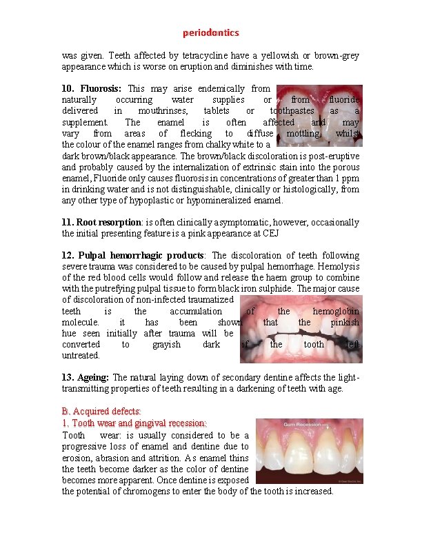 periodontics was given. Teeth affected by tetracycline have a yellowish or brown-grey appearance which