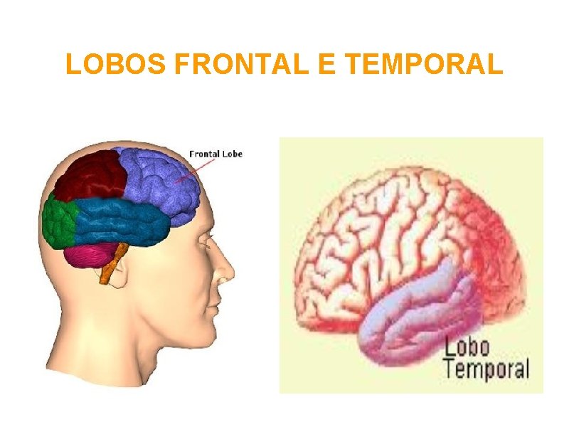 LOBOS FRONTAL E TEMPORAL 