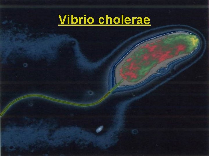 Vibrio cholerae 