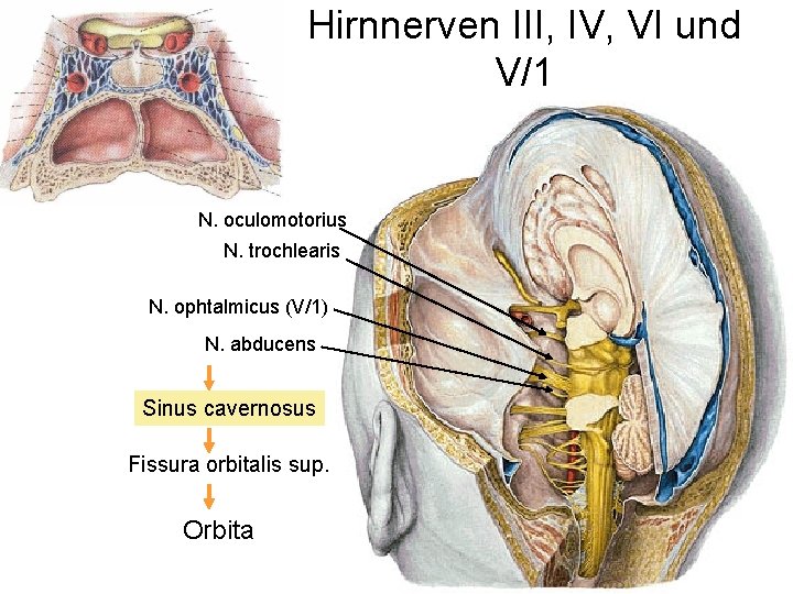 Hirnnerven III, IV, VI und V/1 N. oculomotorius N. trochlearis N. ophtalmicus (V/1) N.