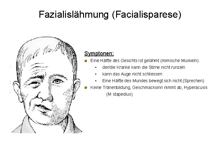 Fazialislähmung (Facialisparese) Symptonen: Eine Hälfte des Gesichts ist gelähmt (mimische Muskeln) • der/die Kranke