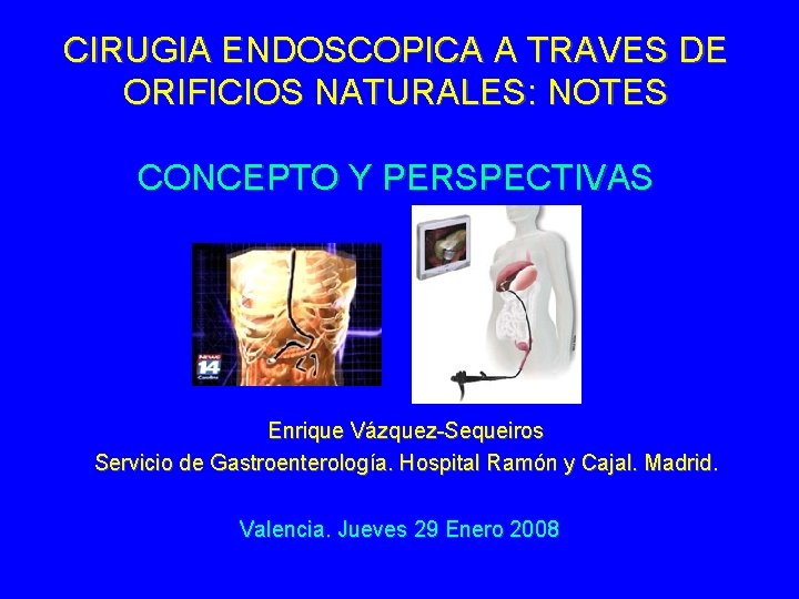 CIRUGIA ENDOSCOPICA A TRAVES DE ORIFICIOS NATURALES: NOTES CONCEPTO Y PERSPECTIVAS Enrique Vázquez-Sequeiros Servicio