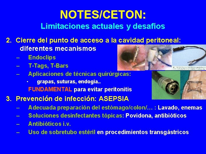 NOTES/CETON: Limitaciones actuales y desafíos 2. Cierre del punto de acceso a la cavidad