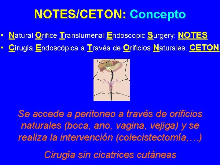 NOTES/CETON: Concepto • Natural Orifice Translumenal Endoscopic Surgery: NOTES • Cirugía Endoscópica a Través