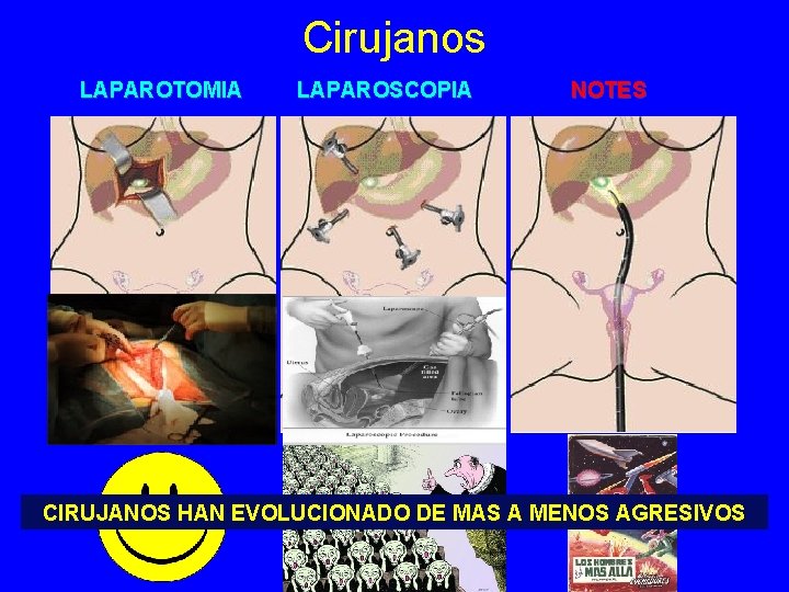 Cirujanos LAPAROTOMIA LAPAROSCOPIA NOTES CIRUJANOS HAN EVOLUCIONADO DE MAS A MENOS AGRESIVOS 