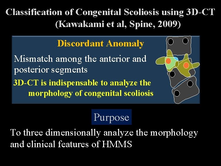 Classification of Congenital Scoliosis using 3 D-CT (Kawakami et al, Spine, 2009) Discordant Anomaly Classification of Congenital Scoliosis using 3 D-CT (Kawakami et al, Spine, 2009) Discordant Anomaly