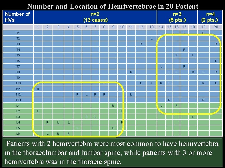 Number and Location of Hemivertebrae in 20 Patient Number of HVs n=2 (13 cases）