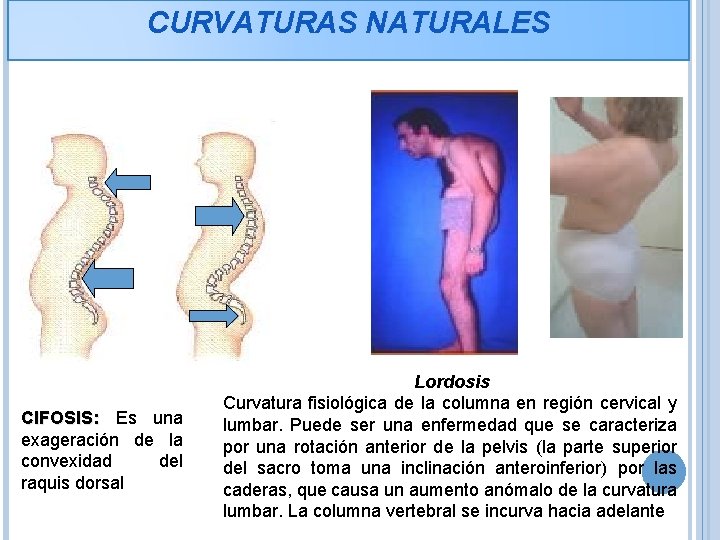 CURVATURAS NATURALES CIFOSIS: Es una exageración de la convexidad del raquis dorsal Lordosis Curvatura