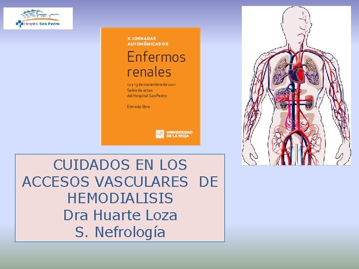 CUIDADOS EN LOS ACCESOS VASCULARES DE HEMODIALISIS Dra Huarte Loza S. Nefrología 