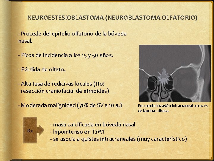 NEUROESTESIOBLASTOMA (NEUROBLASTOMA OLFATORIO) - Procede del epitelio olfatorio de la bóveda nasal. - Picos