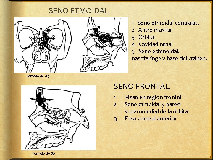 SENO ETMOIDAL 1 Seno etmoidal contralat. 2 Antro maxilar 3 Órbita 4 Cavidad nasal
