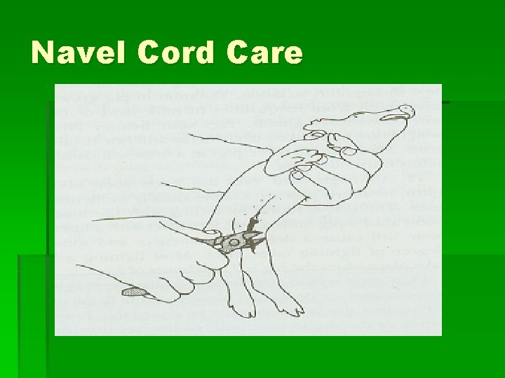 Navel Cord Care 