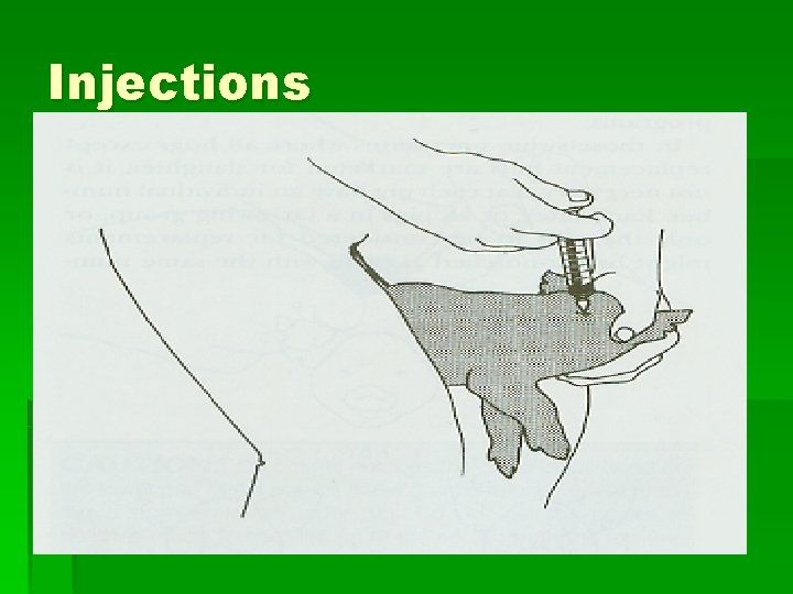 Injections Injections