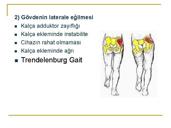 2) Gövdenin laterale eğilmesi n Kalça adduktor zayıflığı n Kalça ekleminde instabilite n Cihazın 2) Gövdenin laterale eğilmesi n Kalça adduktor zayıflığı n Kalça ekleminde instabilite n Cihazın