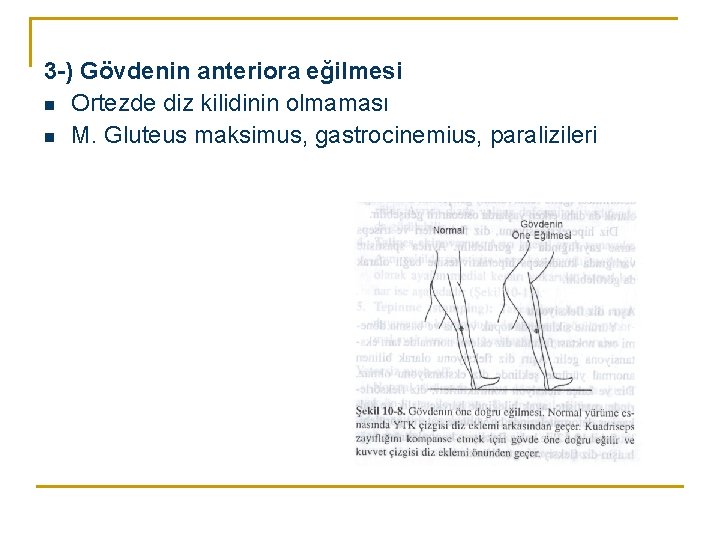 3 -) Gövdenin anteriora eğilmesi n Ortezde diz kilidinin olmaması n M. Gluteus maksimus, 3 -) Gövdenin anteriora eğilmesi n Ortezde diz kilidinin olmaması n M. Gluteus maksimus,