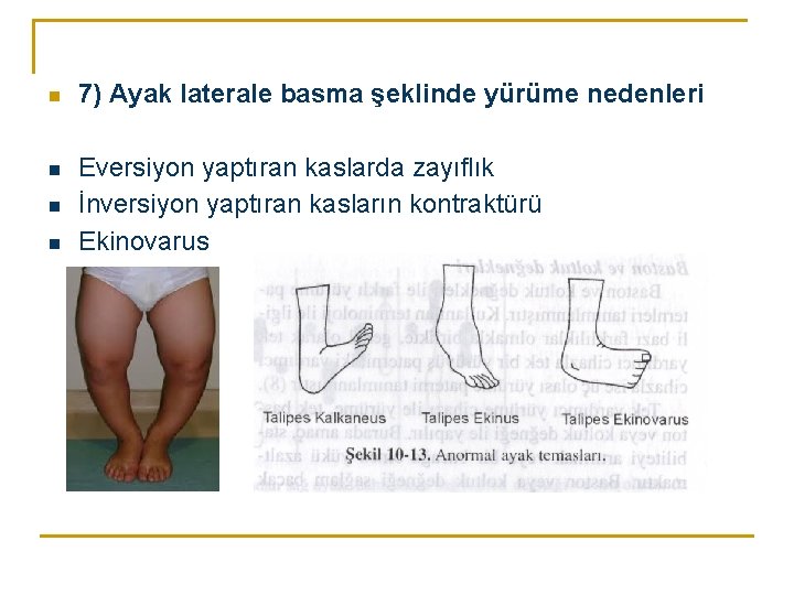 n 7) Ayak laterale basma şeklinde yürüme nedenleri n Eversiyon yaptıran kaslarda zayıflık İnversiyon n 7) Ayak laterale basma şeklinde yürüme nedenleri n Eversiyon yaptıran kaslarda zayıflık İnversiyon