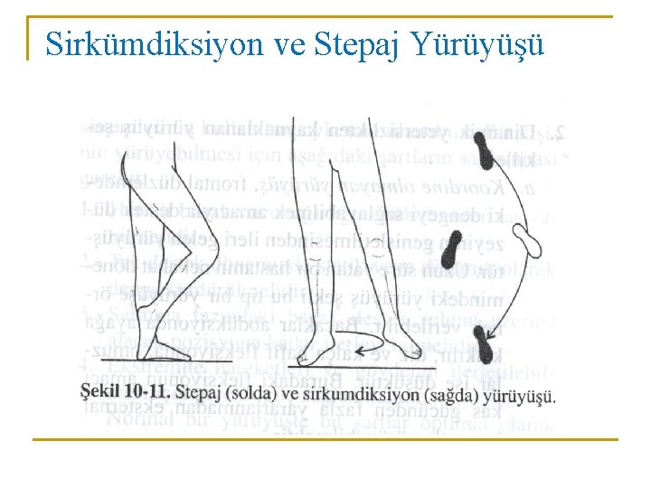 Sirkümdiksiyon ve Stepaj Yürüyüşü Sirkümdiksiyon ve Stepaj Yürüyüşü