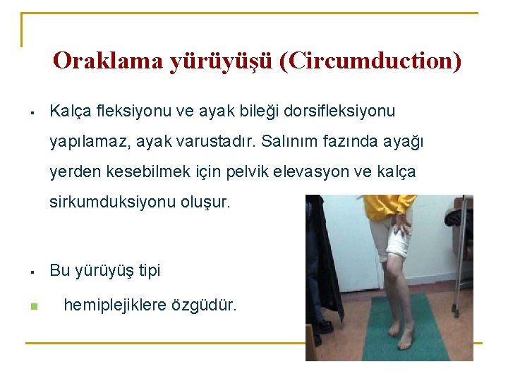 Oraklama yürüyüşü (Circumduction) ▪ Kalça fleksiyonu ve ayak bileği dorsifleksiyonu yapılamaz, ayak varustadır. Salınım Oraklama yürüyüşü (Circumduction) ▪ Kalça fleksiyonu ve ayak bileği dorsifleksiyonu yapılamaz, ayak varustadır. Salınım