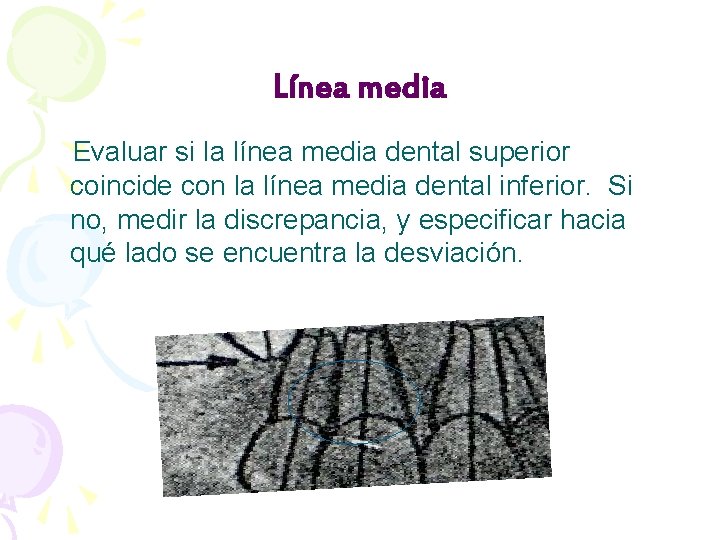 Línea media Evaluar si la línea media dental superior coincide con la línea media