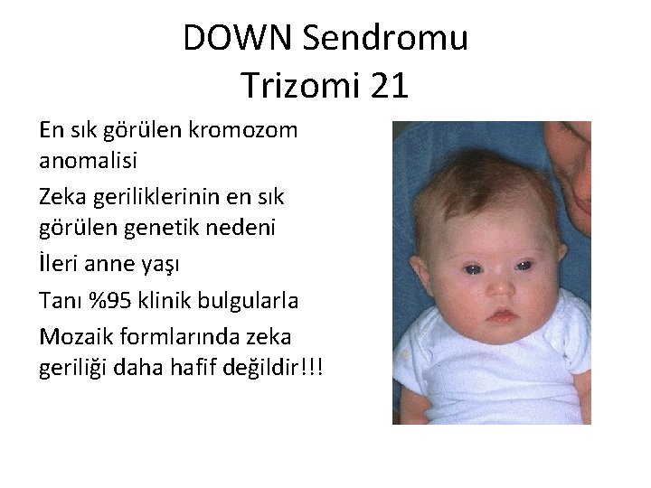 DOWN Sendromu Trizomi 21 En sık görülen kromozom anomalisi Zeka geriliklerinin en sık görülen