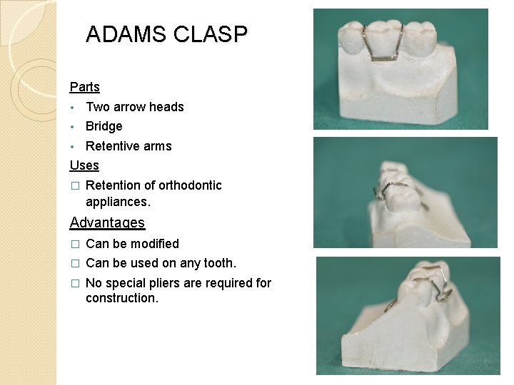 ADAMS CLASP Parts • Two arrow heads • Bridge • Retentive arms Uses �