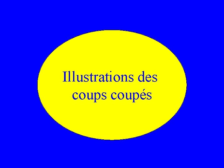 Illustrations des coupés 