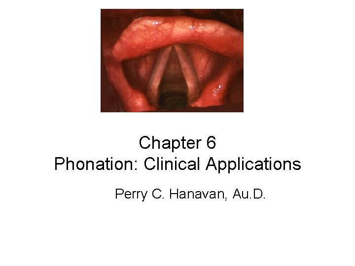Chapter 6 Phonation: Clinical Applications Perry C. Hanavan, Au. D. Chapter 6 Phonation: Clinical Applications Perry C. Hanavan, Au. D.