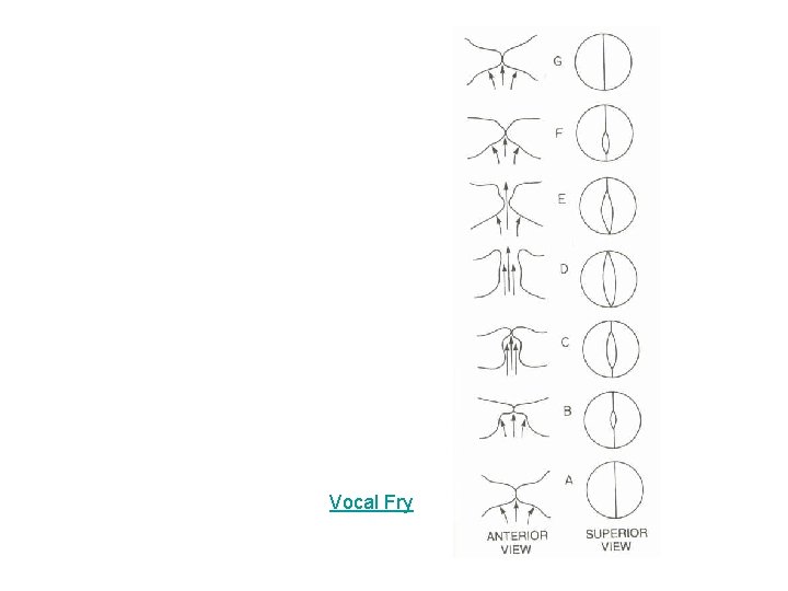 Vocal Fry Vocal Fry