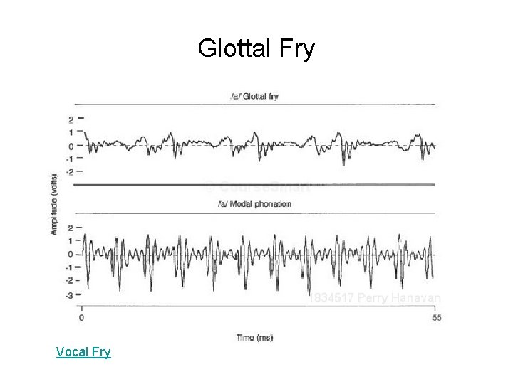 Glottal Fry Vocal Fry Glottal Fry Vocal Fry