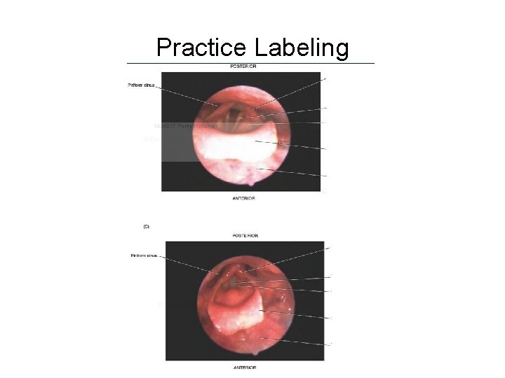 Practice Labeling Practice Labeling