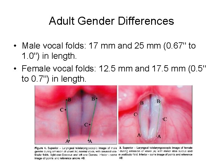 Adult Gender Differences • Male vocal folds: 17 mm and 25 mm (0. 67" Adult Gender Differences • Male vocal folds: 17 mm and 25 mm (0. 67"