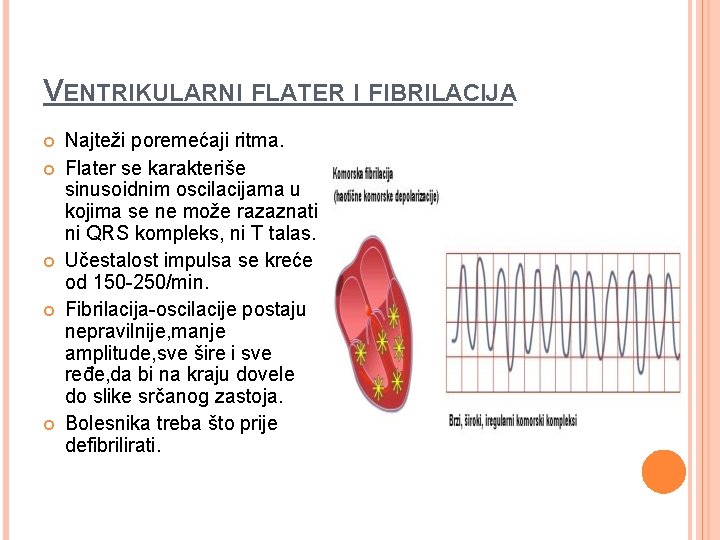 VENTRIKULARNI FLATER I FIBRILACIJA Najteži poremećaji ritma. Flater se karakteriše sinusoidnim oscilacijama u kojima
