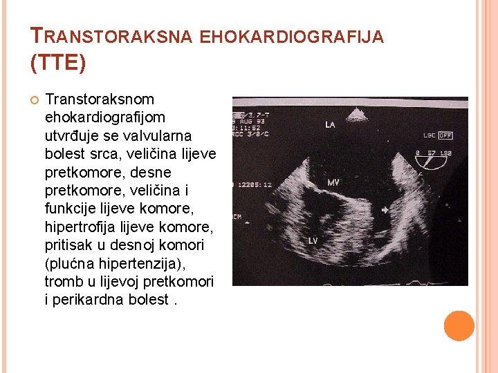 TRANSTORAKSNA EHOKARDIOGRAFIJA (TTE) Transtoraksnom ehokardiografijom utvrđuje se valvularna bolest srca, veličina lijeve pretkomore, desne