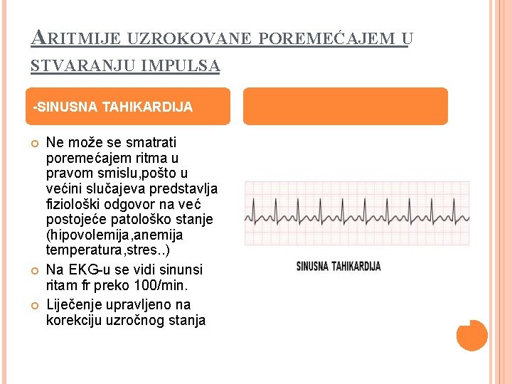 ARITMIJE UZROKOVANE POREMEĆAJEM U STVARANJU IMPULSA -SINUSNA TAHIKARDIJA Ne može se smatrati poremećajem ritma